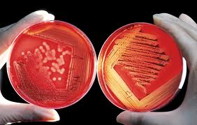 Μικροβιολογικές Εξετάσεις